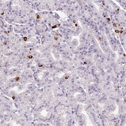 Invitrogen ASB1 Polyclonal Antibody 100 &mu;L; Unconjugated:Antibodies,