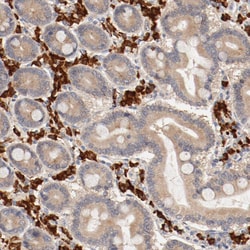 Invitrogen UBE2J1 Polyclonal Antibody 100 &mu;L; Unconjugated:Antibodies,