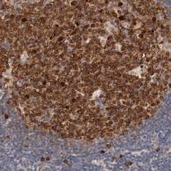 Invitrogen UBE2J1 Polyclonal Antibody 100 &mu;L; Unconjugated:Antibodies,