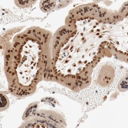 Invitrogen UBE2J1 Polyclonal Antibody 100 &mu;L; Unconjugated:Antibodies,