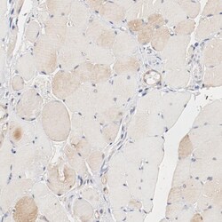 Invitrogen UBE2J1 Polyclonal Antibody 100 &mu;L; Unconjugated:Antibodies,
