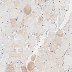 Invitrogen UBE2J1 Polyclonal Antibody 100 &mu;L; Unconjugated:Antibodies,
