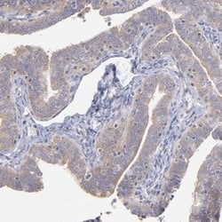 Invitrogen RPLP0 Polyclonal Antibody 100 &mu;L | Buy Online | Invitrogen&trade; | Fisher Scientific