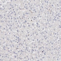 Invitrogen RPLP0 Polyclonal Antibody 100 &mu;L | Buy Online | Invitrogen&trade; | Fisher Scientific
