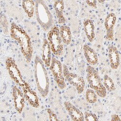 Invitrogen MTERFD3 Polyclonal Antibody 100 &mu;L | Buy Online | Invitrogen&trade; | Fisher Scientific