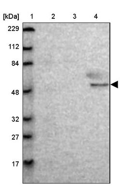 Invitrogen MTERFD3 Polyclonal Antibody 100 &mu;L | Buy Online | Invitrogen&trade; | Fisher Scientific