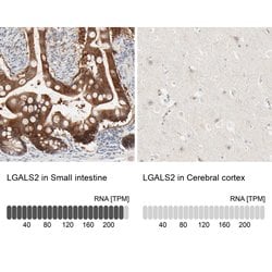 Invitrogen Galectin 2 Polyclonal Antibody 100 &mu;L; Unconjugated:Antibodies,