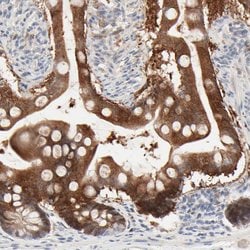 Invitrogen Galectin 2 Polyclonal Antibody 100 &mu;L; Unconjugated:Antibodies,