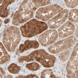 Invitrogen Galectin 2 Polyclonal Antibody 100 &mu;L; Unconjugated:Antibodies,