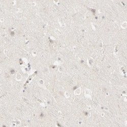 Invitrogen Galectin 2 Polyclonal Antibody 100 &mu;L; Unconjugated:Antibodies,