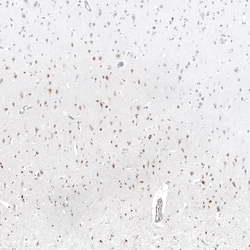 Invitrogen MAGED4 Polyclonal Antibody 100 &mu;L; Unconjugated:Antibodies,