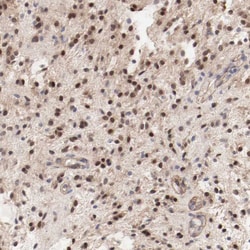 Invitrogen MAGED4 Polyclonal Antibody 100 &mu;L; Unconjugated:Antibodies,