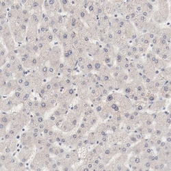 Invitrogen MAGED4 Polyclonal Antibody 100 &mu;L; Unconjugated:Antibodies,