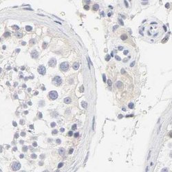 Invitrogen FCGBP Polyclonal Antibody 100 &mu;L; Unconjugated:Antibodies,