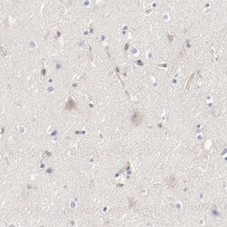 Invitrogen ARHGEF6 Polyclonal Antibody 100 &mu;L; Unconjugated:Antibodies,