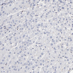 Invitrogen ARHGEF6 Polyclonal Antibody 100 &mu;L; Unconjugated:Antibodies,