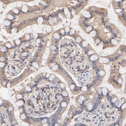 Invitrogen ARHGEF6 Polyclonal Antibody 100 &mu;L; Unconjugated:Antibodies,