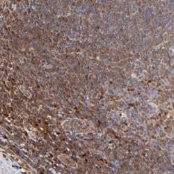 Invitrogen ARHGEF6 Polyclonal Antibody 100 &mu;L; Unconjugated:Antibodies,