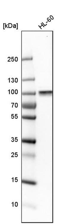 Invitrogen ARHGEF6 Polyclonal Antibody 100 &mu;L; Unconjugated:Antibodies,