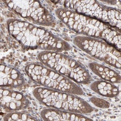 Invitrogen SCFD1 Polyclonal Antibody 100 &mu;L | Buy Online | Invitrogen&trade; | Fisher Scientific