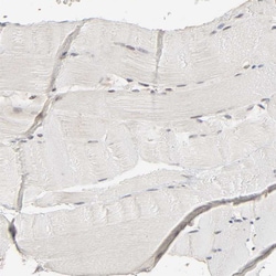 Invitrogen SCFD1 Polyclonal Antibody 100 &mu;L | Buy Online | Invitrogen&trade; | Fisher Scientific