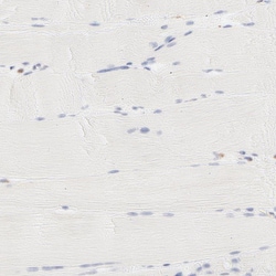 Invitrogen PARP12 Polyclonal Antibody 100 &mu;L; Unconjugated:Anticuerpos