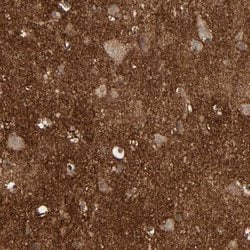 Invitrogen NDRG2 Polyclonal Antibody 100 &mu;L; Unconjugated:Antibodies,
