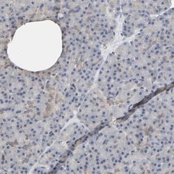 Invitrogen NDRG2 Polyclonal Antibody 100 &mu;L; Unconjugated:Antibodies,