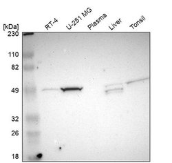 Invitrogen NDRG2 Polyclonal Antibody 100 &mu;L; Unconjugated:Antibodies,
