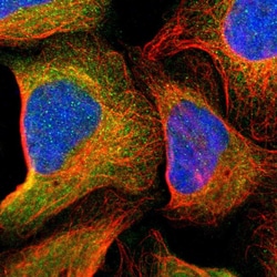 Invitrogen ASMTL Polyclonal Antibody 100 &mu;L; Unconjugated:Antibodies,