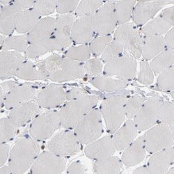 Invitrogen ASMTL Polyclonal Antibody 100 &mu;L; Unconjugated:Antibodies,