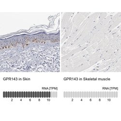 GPR143 Polyclonal Antibody, Invitrogen 100 &mu;L; Unconjugated:Antibodies,