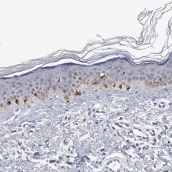 GPR143 Polyclonal Antibody, Invitrogen 100 &mu;L; Unconjugated:Antibodies,