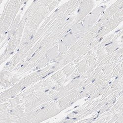 GPR143 Polyclonal Antibody, Invitrogen 100 &mu;L; Unconjugated:Antibodies,