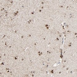 Invitrogen RGAG4 Polyclonal Antibody 100 &mu;L; Unconjugated:Antibodies,