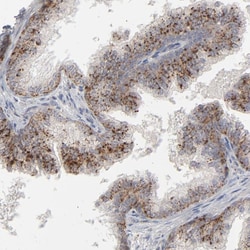Invitrogen POMT2 Polyclonal Antibody 100 &mu;L; Unconjugated:Antibodies,