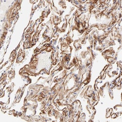 Invitrogen NPNT Polyclonal Antibody 100 &mu;L; Unconjugated:Antibodies,