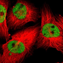 Invitrogen ZNF3 Polyclonal Antibody 100 &mu;L; Unconjugated:Antibodies,