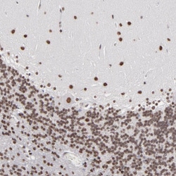 Invitrogen ZNF3 Polyclonal Antibody 100 &mu;L; Unconjugated:Antibodies,