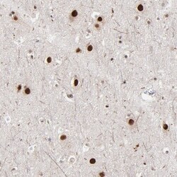 Invitrogen ZNF3 Polyclonal Antibody 100 &mu;L; Unconjugated:Antibodies,