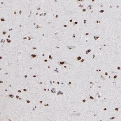 Invitrogen ZNF3 Polyclonal Antibody 100 &mu;L; Unconjugated:Antibodies,