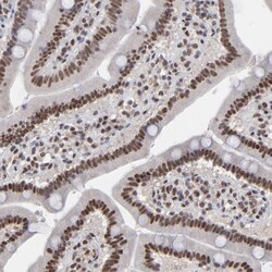 Invitrogen ZNF3 Polyclonal Antibody 100 &mu;L; Unconjugated:Antibodies,
