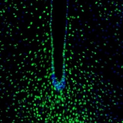 Invitrogen ZNF3 Polyclonal Antibody 100 &mu;L; Unconjugated:Antibodies,
