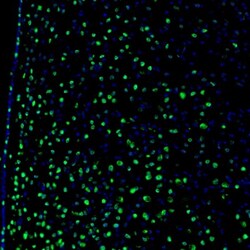 Invitrogen ZNF3 Polyclonal Antibody 100 &mu;L; Unconjugated:Antibodies,