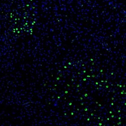 Invitrogen ZNF3 Polyclonal Antibody 100 &mu;L; Unconjugated:Antibodies,