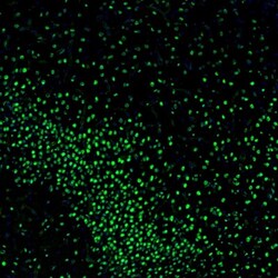 Invitrogen ZNF3 Polyclonal Antibody 100 &mu;L; Unconjugated:Antibodies,