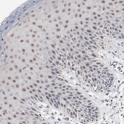 Invitrogen ERICH1 Polyclonal Antibody 100 &mu;L | Buy Online | Invitrogen&trade; | Fisher Scientific