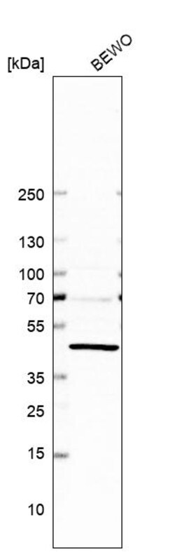 Invitrogen ERICH1 Polyclonal Antibody 100 &mu;L | Buy Online | Invitrogen&trade; | Fisher Scientific