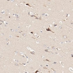 Invitrogen DYNC1H1 Polyclonal Antibody 100 &mu;L; Unconjugated:Antibodies,