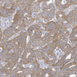 Invitrogen TRMT2B Polyclonal Antibody 100 &mu;L | Buy Online | Invitrogen&trade; | Fisher Scientific